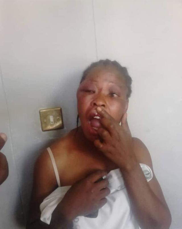 Brutal Beating of MDC Official